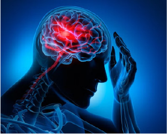 Problemas cerebrovasculares