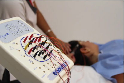 Electroencefalografía