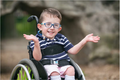 Malformaciones cerebrales